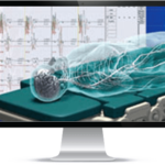 İONM Nedir , ionm nedir , intraoperatif nöromonitorizasyon nedir , intraoperatif nöromonitorizasyon? , intraoperatif nöromonitorizasyon , ast medikal , astmed